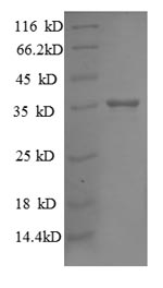 Recombinant Escherichia coli 30S ribosomal protein S18 (rpsR) – Figure 1 of 1
