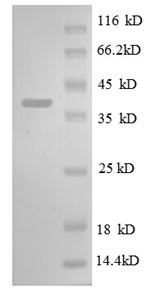 Recombinant Escherichia coli 30S ribosomal protein S13 (rpsM) – Figure 1 of 1