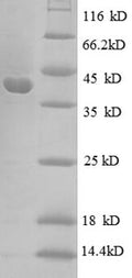 Recombinant Escherichia coli 30S ribosomal protein S10 (rpsJ) – Figure 1 of 1