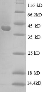 Recombinant Escherichia coli 30S ribosomal protein S10 (rpsJ) – Figure 1 of 1