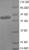 Recombinant Escherichia coli 50S ribosomal protein L9 (rplI), partial – Figure 1 of 1
