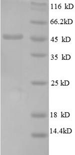 Recombinant Escherichia coli 50S ribosomal protein L6 (rplF), partial – Figure 1 of 1
