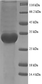 Recombinant Escherichia coli 50S ribosomal protein L35 (rpmI), partial – Figure 1 of 1