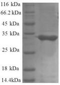 Recombinant Escherichia coli 50S ribosomal protein L34 (rpmH) – Figure 1 of 1