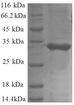 Recombinant Escherichia coli 50S ribosomal protein L34 (rpmH) – Figure 1 of 1