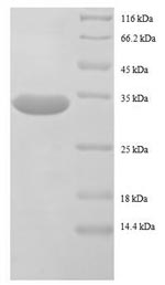 Recombinant Escherichia coli 50S ribosomal protein L32 (rpmF) – Figure 1 of 1