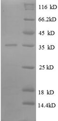 Recombinant Escherichia coli 50S ribosomal protein L31 (rpmE) – Figure 1 of 1