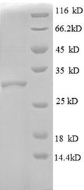(Tris-Glycine gel) Discontinuous SDS-PAGE (reduced) with 5% enrichment gel and 15% separation gel.