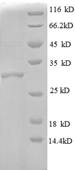 (Tris-Glycine gel) Discontinuous SDS-PAGE (reduced) with 5% enrichment gel and 15% separation gel.