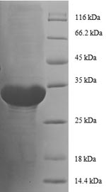 (Tris-Glycine gel) Discontinuous SDS-PAGE (reduced) with 5% enrichment gel and 15% separation gel.