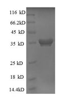 Recombinant Escherichia coli 50S ribosomal protein L28 (rpmB) – Figure 1 of 1