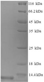 Recombinant Mouse C-C motif chemokine 3 (Ccl3) – Figure 1 of 1