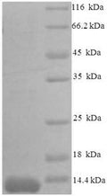 Recombinant Mouse C-C motif chemokine 7 (Ccl7), partial – Figure 1 of 1