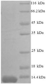 Recombinant Mouse C-C motif chemokine 7 (Ccl7), partial – Figure 1 of 1