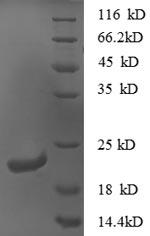 Recombinant Mouse C-X-C motif chemokine 16 (Cxcl16), partial – Figure 1 of 1
