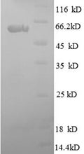 Recombinant Human SPARC (SPARC) – Figure 1 of 1