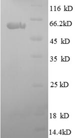 Recombinant Human SPARC (SPARC) – Figure 1 of 1