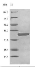 (Tris-Glycine gel) Discontinuous SDS-PAGE (reduced) with 5% enrichment gel and 15% separation gel.