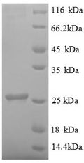 Recombinant Human Ubiquitin-conjugating enzyme E2 K (UBE2K) – Figure 1 of 1