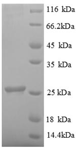 Recombinant Human Ubiquitin-conjugating enzyme E2 K (UBE2K) – Figure 1 of 1