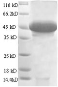 (Tris-Glycine gel) Discontinuous SDS-PAGE (reduced) with 5% enrichment gel and 15% separation gel.