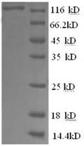 Recombinant Human Glycogen phosphorylase, brain form (PYGB), partial – Figure 1 of 1