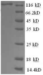 Recombinant Human Glycogen phosphorylase, brain form (PYGB), partial – Figure 1 of 1