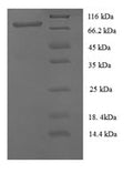 Recombinant Human Cell surface glycoprotein MUC18 (MCAM), partial – Figure 1 of 1