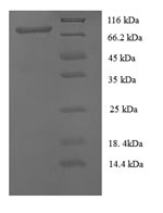Recombinant Human Cell surface glycoprotein MUC18 (MCAM), partial – Figure 1 of 1