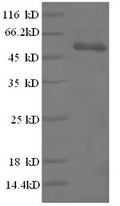 (Tris-Glycine gel) Discontinuous SDS-PAGE (reduced) with 5% enrichment gel and 15% separation gel.