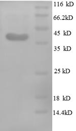 Recombinant Human Midkine (MDK) – Figure 1 of 1