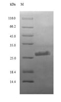 (Tris-Glycine gel) Discontinuous SDS-PAGE (reduced) with 5% enrichment gel and 15% separation gel.