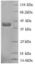 (Tris-Glycine gel) Discontinuous SDS-PAGE (reduced) with 5% enrichment gel and 15% separation gel.