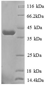 (Tris-Glycine gel) Discontinuous SDS-PAGE (reduced) with 5% enrichment gel and 15% separation gel.