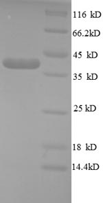 (Tris-Glycine gel) Discontinuous SDS-PAGE (reduced) with 5% enrichment gel and 15% separation gel.