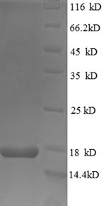 (Tris-Glycine gel) Discontinuous SDS-PAGE (reduced) with 5% enrichment gel and 15% separation gel.