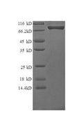 Recombinant Human Granulocyte colony-stimulating factor receptor (CSF3R), partial – Figure 1 of 1