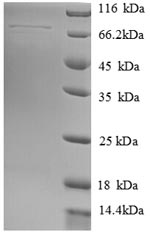 Recombinant Human Heat shock 70KDA protein 13 (HSPA13) – Figure 1 of 1