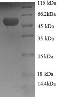 Recombinant Human Hydroxyacylglutathione hydrolase, mitochondrial (GLO2), partial – Figure 1 of 1