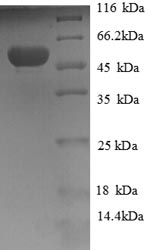 Recombinant Human Hydroxyacylglutathione hydrolase, mitochondrial (GLO2), partial – Figure 1 of 1