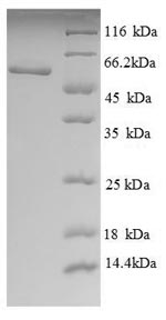 Recombinant Human Phosphatidylcholine-sterol acyltransferase (LCAT), partial – Figure 1 of 1