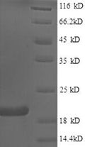 Recombinant Human Bis (5'-adenosyl)-triphosphatase (FHIT) – Figure 1 of 1