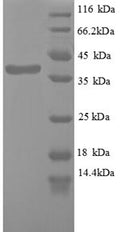 Recombinant Human Wilms tumor protein (WT1), partial – Figure 1 of 1