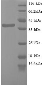Recombinant Human Wilms tumor protein (WT1), partial – Figure 1 of 1