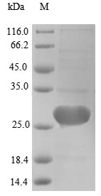 (Tris-Glycine gel) Discontinuous SDS-PAGE (reduced) with 5% enrichment gel and 15% separation gel.