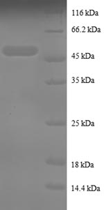 Recombinant Human Tumor necrosis factor alpha-induced protein 8 (TNFAIP8) – Figure 1 of 1