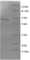 (Tris-Glycine gel) Discontinuous SDS-PAGE (reduced) with 5% enrichment gel and 15% separation gel.