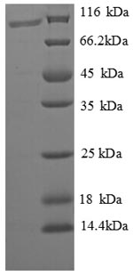 Recombinant Nosema bombycis Polar tube protein 3 (PTP3), partial – Figure 1 of 1
