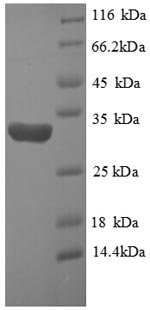 Recombinant Human Hypoxia-inducible factor 1-alpha (HIF1A), partial – Figure 1 of 1