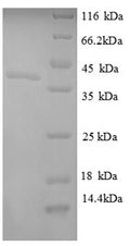 Recombinant Escherichia coli Ornithine carbamoyltransferase subunit F (argF) – Figure 1 of 1